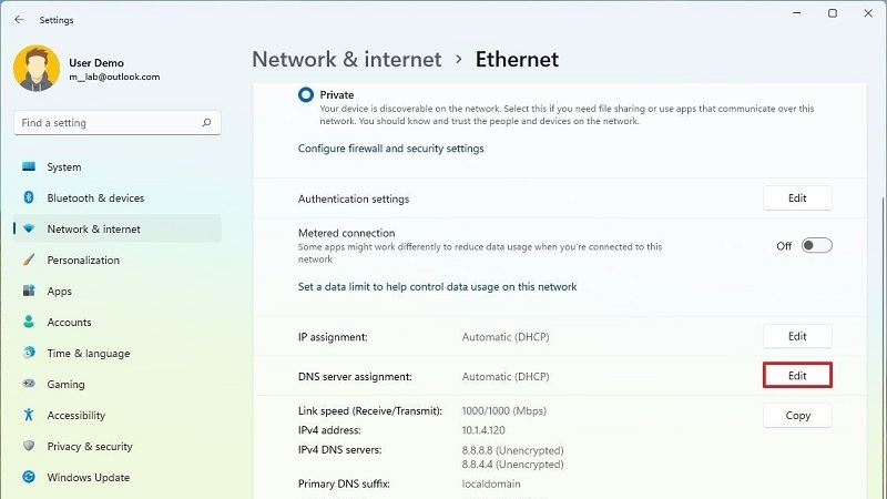 Mục DNS server assignment với nút Edit được khoanh đỏ Mục DNS server assignment với nút Edit được khoanh đỏ